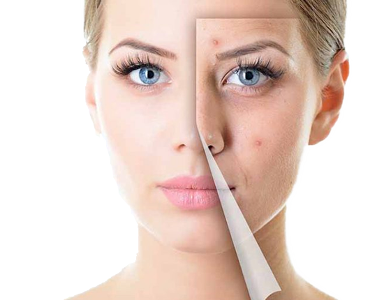 Красивая кожа без прыщей: эффективное лечение акне у дерматолога в «Комильфо»