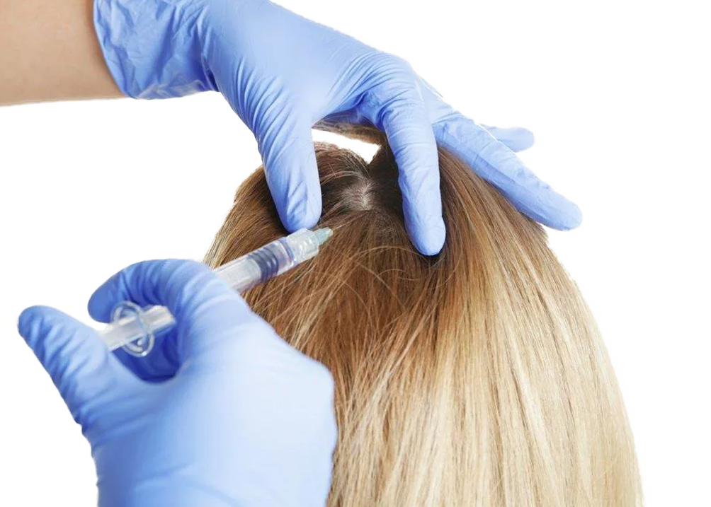 Профессиональное лечение выпадения волос у женщин на голове доступное каждому